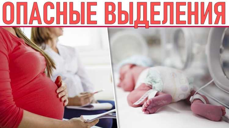 Физические нагрузки и их влияние на отеки
