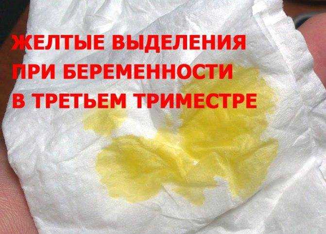 Что означают обильные выделения во время беременности?